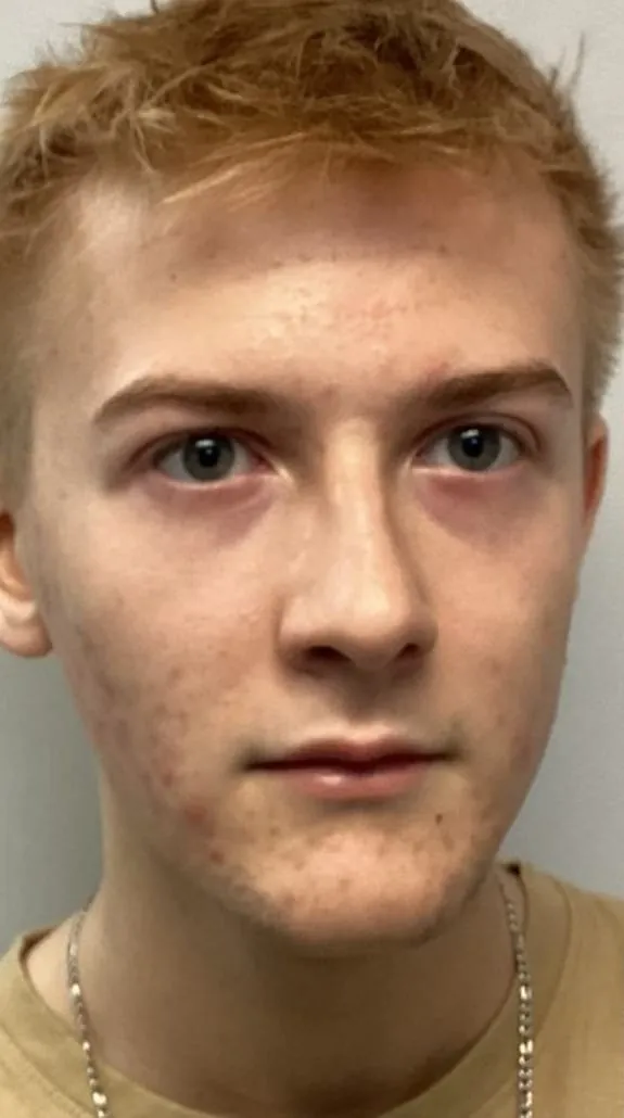 Male facial skin before treatment series