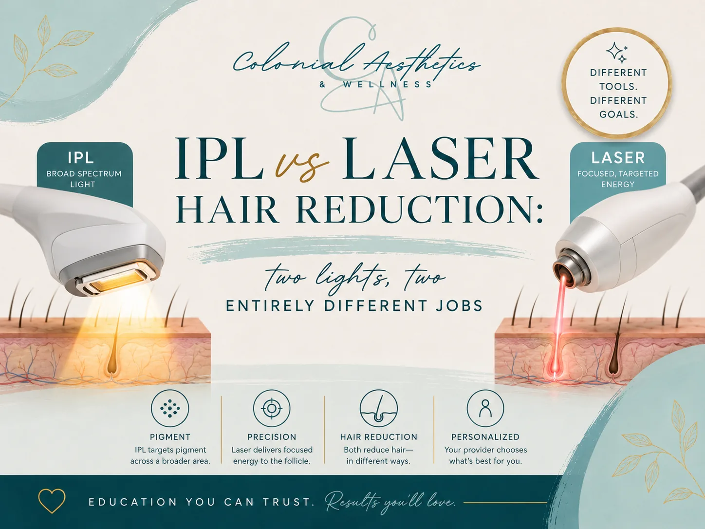 IPL and laser hair reduction handpieces treating skin — Colonial Aesthetics & Wellness comparison