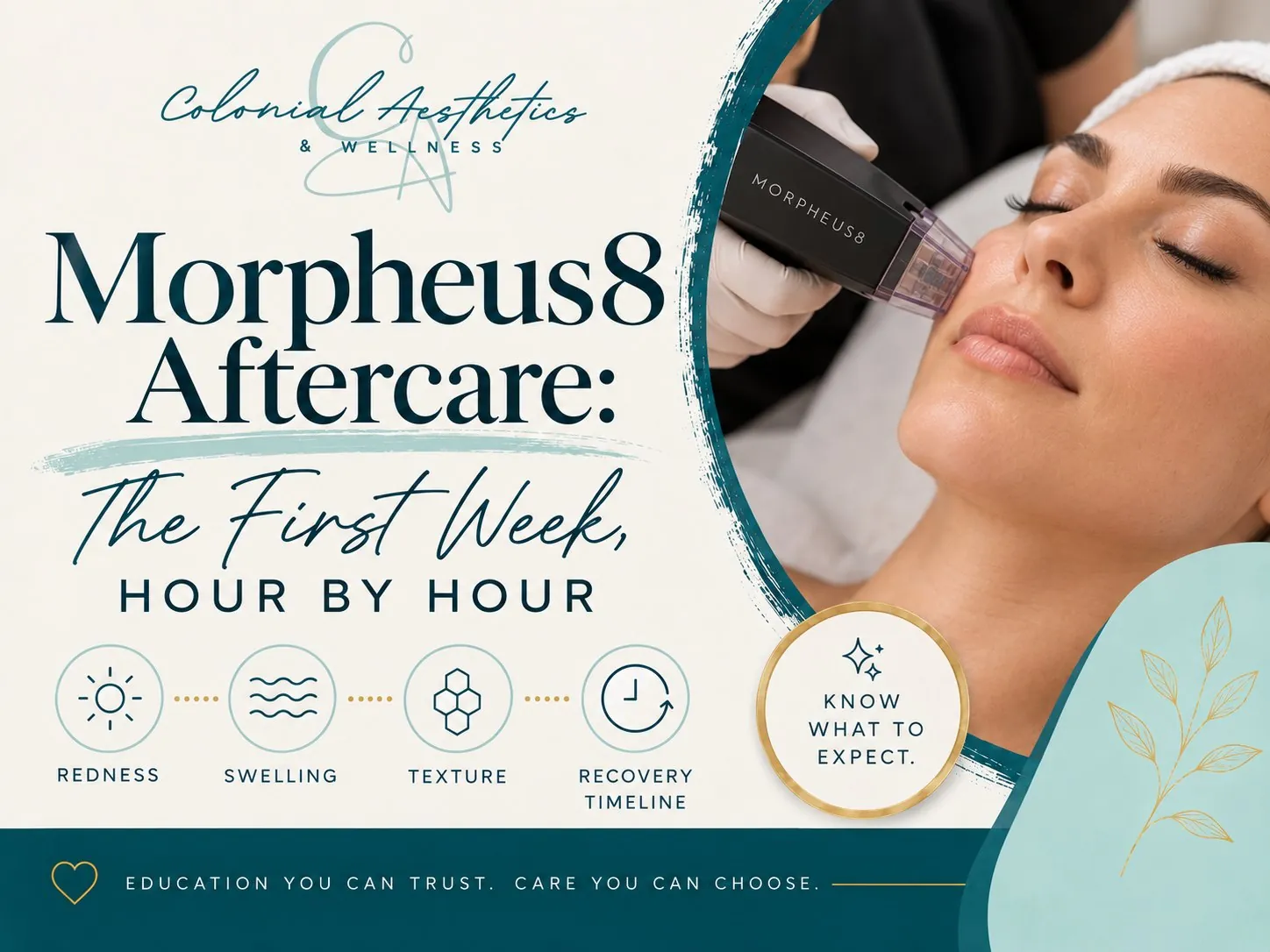 Morpheus8 aftercare guide — a Morpheus8 handpiece treating the cheek, Colonial Aesthetics & Wellness, Williamsburg VA