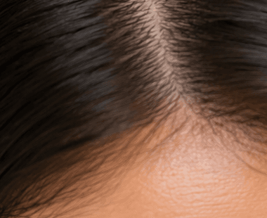 Close-up of healthy hair and scalp