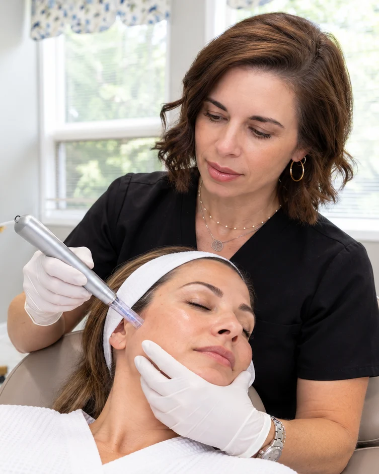 Microneedling